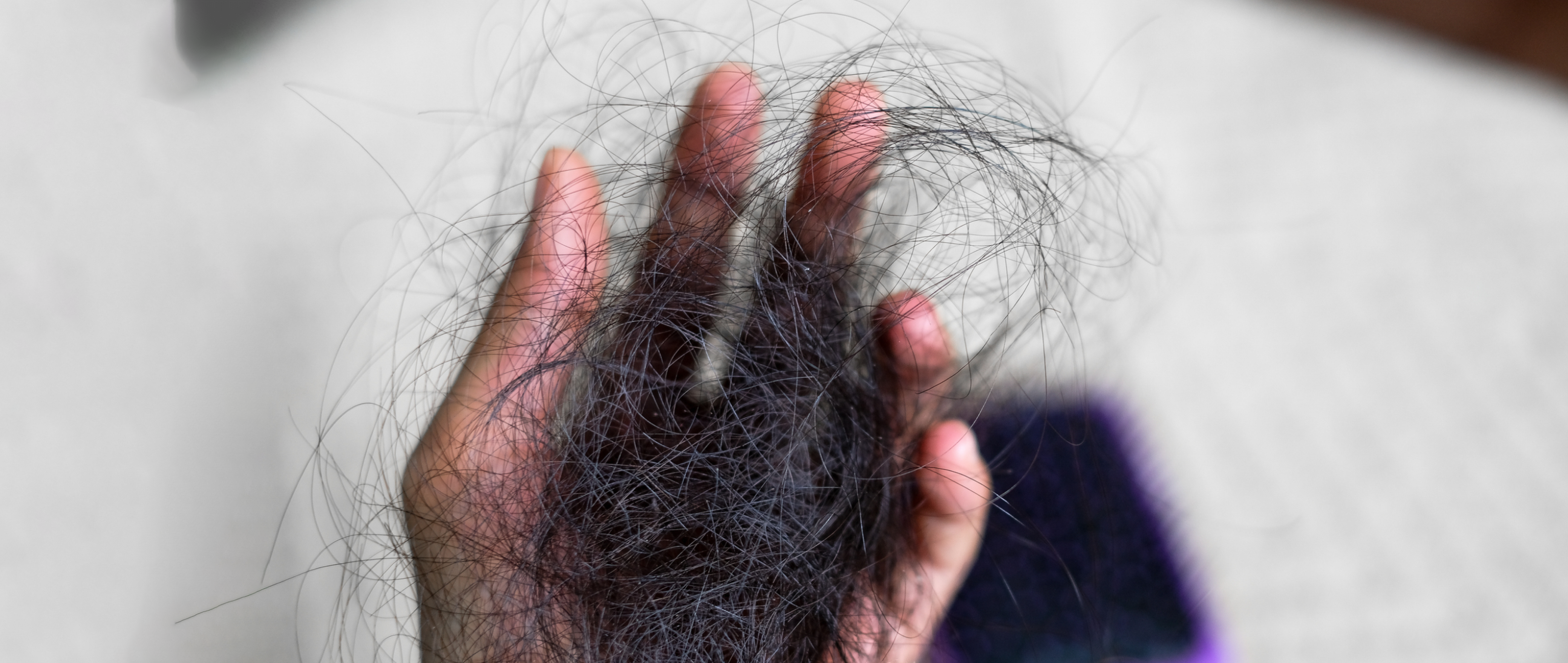 Stop Hair Loss Now: Your Top Defence for a Thriving Mane